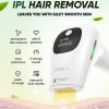 دستگاه لیزر موهای زائد دائمی XSOUL At-Home IPL Hair Removal
